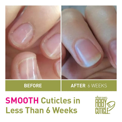 Abby™️ Cuticle Oil
